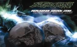 Authority : Kerusakan Sistem Otak